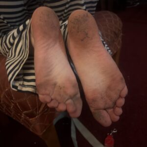 Tootsies